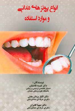 انواع پروتزهاي دنداني و موارد استفاده