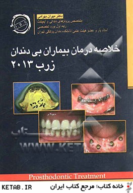 خلاصه درمان بيماران بي دندان زرب 2013