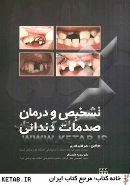 تشخيص و درمان صدمات دنداني
