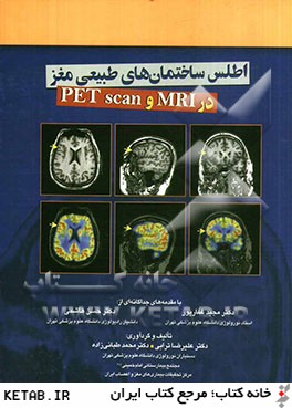 اطلس ساختمان هاي طبيعي مغز در MRI و PET scan