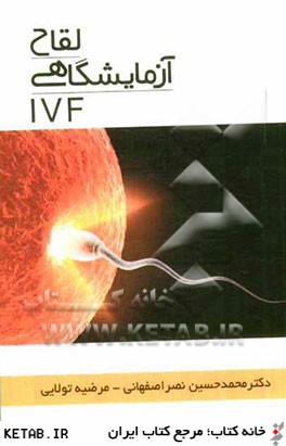 لقاح آزمايشگاهي (IVF)