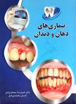 بيماري هاي دهان و دندان